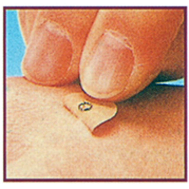 Nihon Yakukou Acupuncture Needles (180 needles)